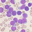 Free medicine for Blood Cancer